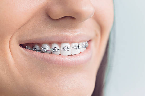 Best Dental Inlays and Onlays  in Atherton, CA
